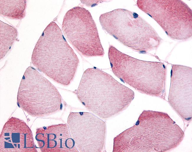CCNL1 / Cyclin L1 Antibody - Anti-CCNL1 / Cyclin L1 antibody IHC of human skeletal muscle. Immunohistochemistry of formalin-fixed, paraffin-embedded tissue after heat-induced antigen retrieval. Antibody concentration 10 ug/ml.