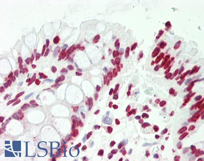 CCNL2 / Cyclin L2 Antibody - Anti-CCNL2 / Cyclin L2 antibody IHC staining of human colon. Immunohistochemistry of formalin-fixed, paraffin-embedded tissue after heat-induced antigen retrieval. Antibody dilution 1:75.