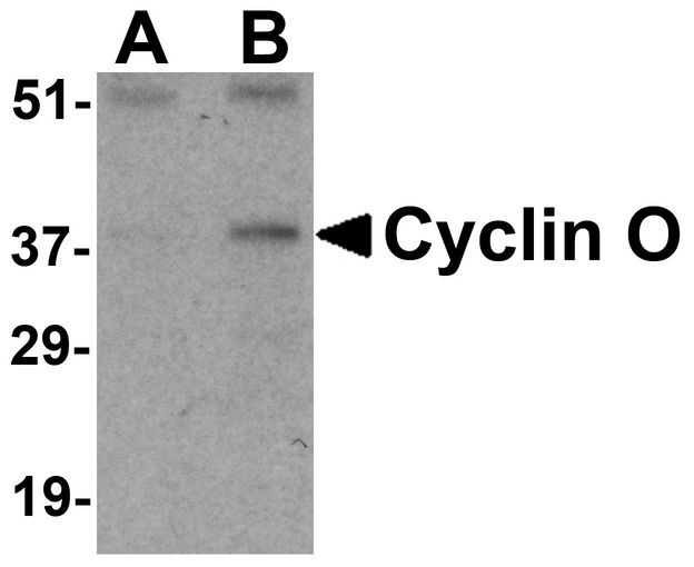 CCNO / UNG2 Antibody - Western blot analysis of Cyclin O in mouse bladder tissue lysate with Cyclin O antibody at (A) 1 and (B) 2 ug/ml.