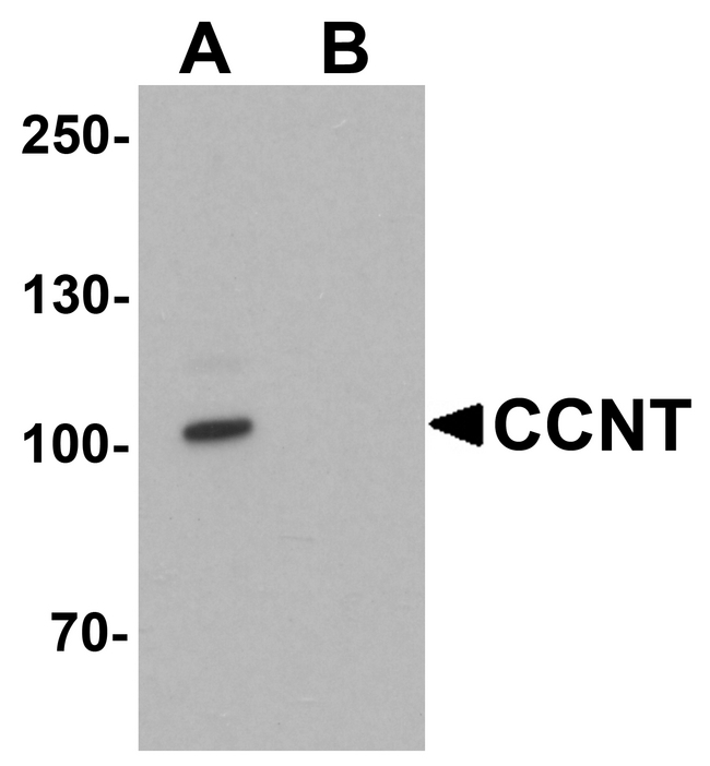 CCNT1 / Cyclin T1 Antibody - Western blot analysis of CCNT1 in rat brain tissue lysate with CCNT1 antibody at 1 ug/ml in (A) the absence and (B) the presence of blocking peptide.