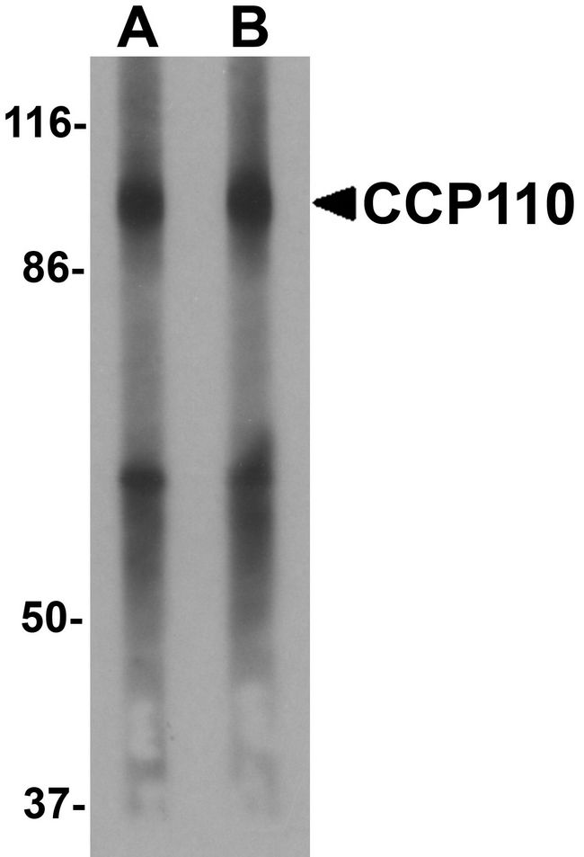 CCP110 Antibody - Western blot analysis of CCP110 in human colon tissue lysate with CCP110 antibody at (A) 1 and (B) 2 ug/ml.