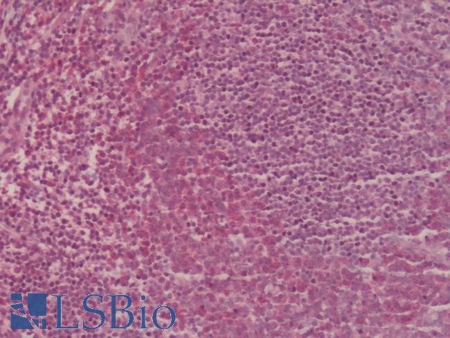 CCR2 Antibody - Human Tonsil: Formalin-Fixed, Paraffin-Embedded (FFPE)