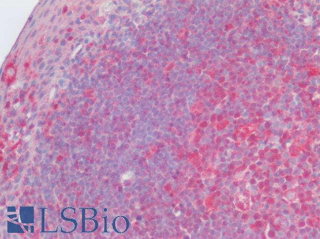 CCR2 Antibody - Human Tonsil: Formalin-Fixed, Paraffin-Embedded (FFPE)