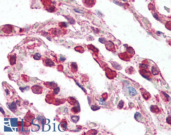 CCR3 Antibody - Anti-CCR3 antibody IHC of human lung. Immunohistochemistry of formalin-fixed, paraffin-embedded tissue after heat-induced antigen retrieval. Antibody concentration 5 ug/ml.