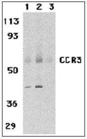 CCR3 Antibody - Western blot of CCR3 in human spleen tissue lysates with CCR3 antibody at 1 (lane 1) and 2 ug/ml (lane 2), and 2 ug/ml in the presence of blocking peptide (lane 3).