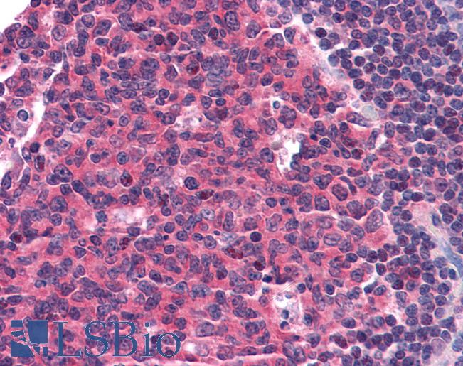 CCR5 Antibody - Anti-CCR5 antibody IHC of human tonsil. Immunohistochemistry of formalin-fixed, paraffin-embedded tissue after heat-induced antigen retrieval. Antibody concentration 20 ug/ml.