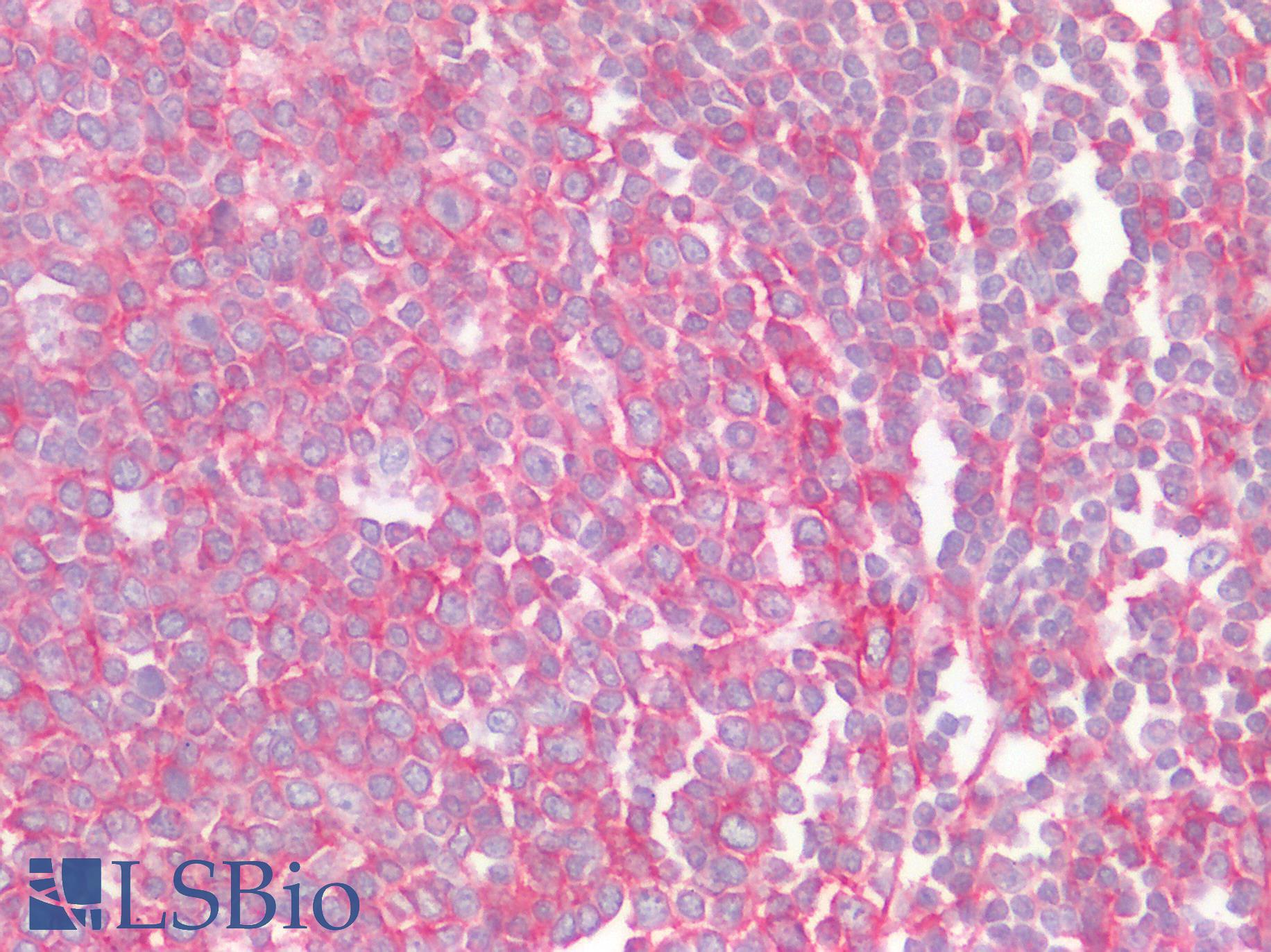CCR6 Antibody - Human Tonsil: Formalin-Fixed, Paraffin-Embedded (FFPE)