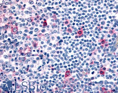 CCR8 / CD198 Antibody - Anti-CCR8 antibody IHC of human tonsil, germinal center and mantle zone. Immunohistochemistry of formalin-fixed, paraffin-embedded tissue after heat-induced antigen retrieval.