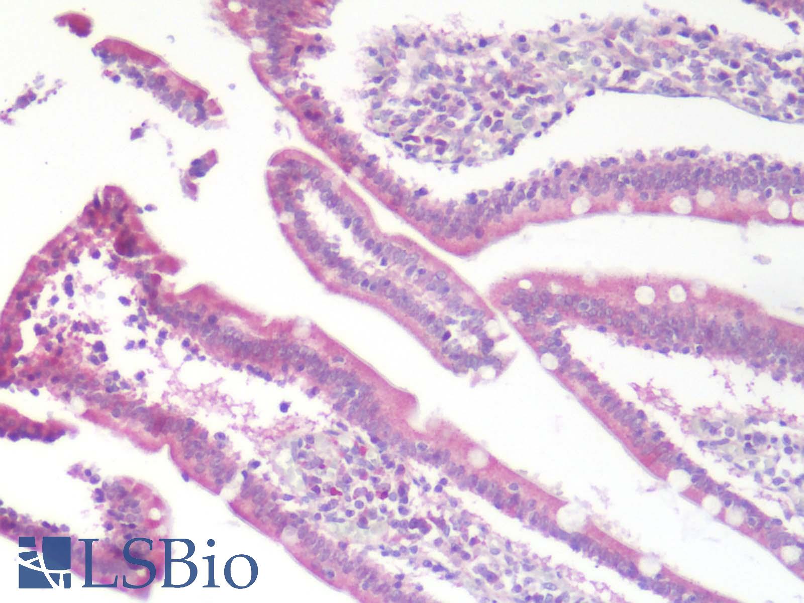 CCR9 / CD199 Antibody - Human Small Intestine: Formalin-Fixed, Paraffin-Embedded (FFPE)