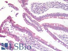 CCR9 / CD199 Antibody - Human Small Intestine: Formalin-Fixed, Paraffin-Embedded (FFPE)