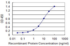 CCS Antibody - Detection limit for recombinant GST tagged CCS is 0.1 ng/ml as a capture antibody.