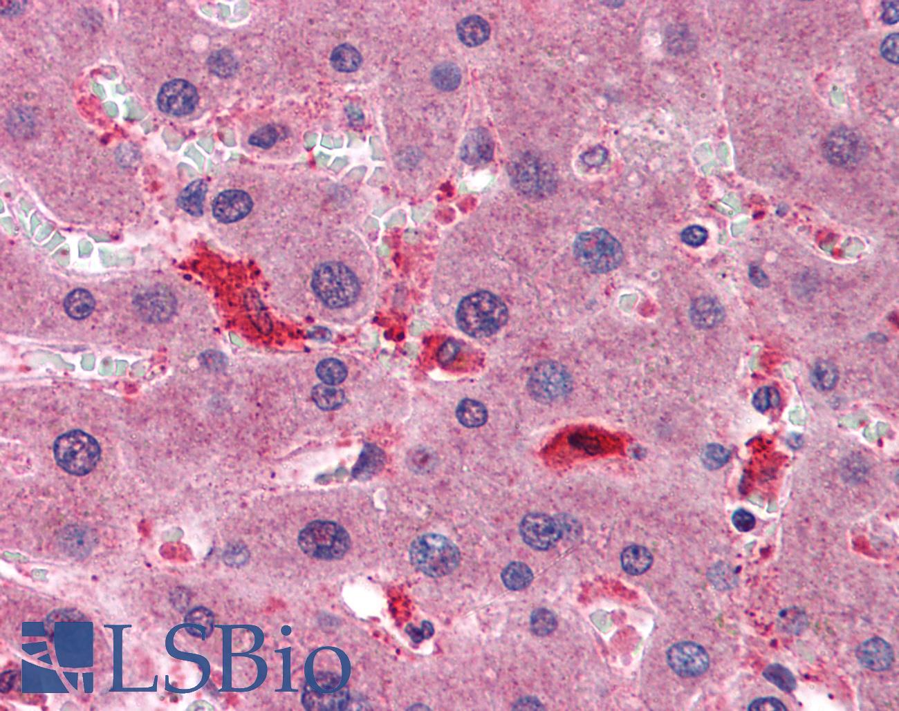 CCS Antibody - Anti-CCS antibody IHC of human liver. Immunohistochemistry of formalin-fixed, paraffin-embedded tissue after heat-induced antigen retrieval. Antibody concentration 1.5 ug/ml.