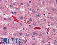 CCS Antibody - Anti-CCS antibody IHC of human liver. Immunohistochemistry of formalin-fixed, paraffin-embedded tissue after heat-induced antigen retrieval. Antibody concentration 1.5 ug/ml.