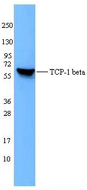 CCT2 / CCT Beta Antibody - HepG2 cell extracts were resolved by electrophoresis, transferred to nitrocellulose, and probed with purified monoclonal TCP-1beta antibody (clone F39P7F11). Proteins were visualized using a goat anti-mouse-IgG secondary conjugated to HRP and chemiluminescence detection.