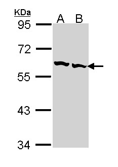 CCT2 / CCT Beta Antibody - Sample (30 ug of whole cell lysate). A: Hep G2. B: Raji. 7.5% SDS PAGE. CCT2 antibody diluted at 1:1000. 