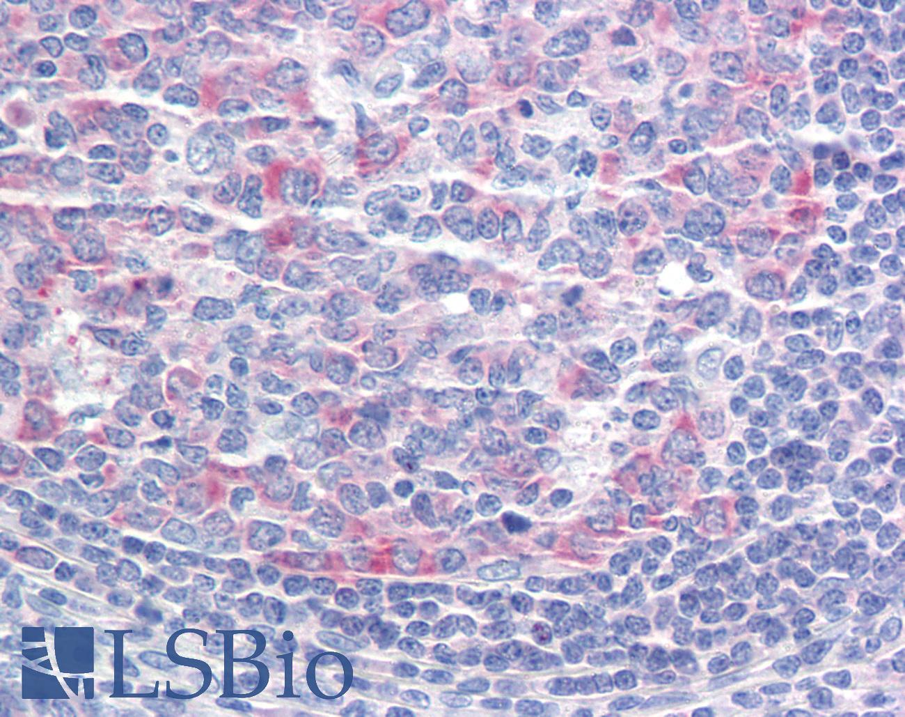 CCT3 Antibody - Anti-CCT3 antibody IHC staining of human tonsil. Immunohistochemistry of formalin-fixed, paraffin-embedded tissue after heat-induced antigen retrieval.