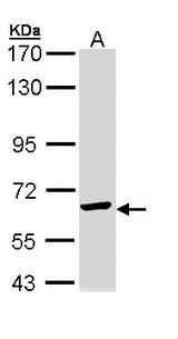 CCT5 / TCP1 Epsilon Antibody - Sample (30 ug of whole cell lysate). A: Molt-4 . 7.5% SDS PAGE. CCT5 / TCP1 Epsilon antibody diluted at 1:1000