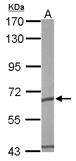 CCT5 / TCP1 Epsilon Antibody - Sample (50 ug of whole cell lysate). A: mouse brain. 7.5% SDS PAGE. CCT5 / TCP1 Epsilon antibody diluted at 1:10000.