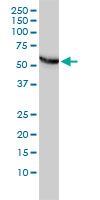 CCT5 / TCP1 Epsilon Antibody - Western blot of CCT5 expression in HeLa cells with CCT5 monoclonal antibody, clone 4E5-4B1.