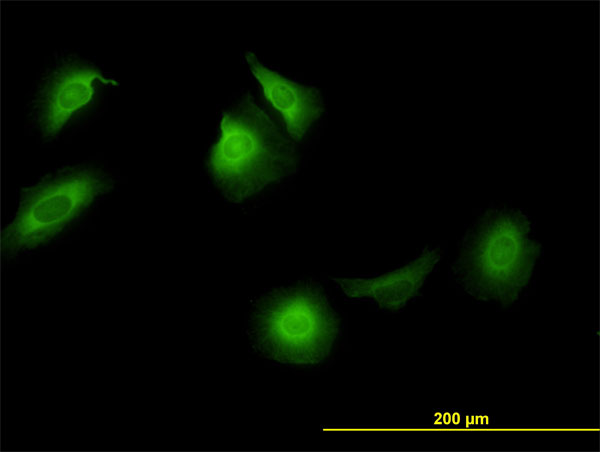 CCT5 / TCP1 Epsilon Antibody - Immunofluorescence of monoclonal antibody to CCT5 on HeLa cell. [antibody concentration 10 ug/ml]