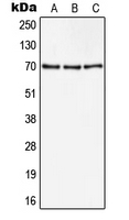 CD105 Antibody - Western blot analysis of CD105 expression in HeLa (A); A549 (B); NIH3T3 (C) whole cell lysates.