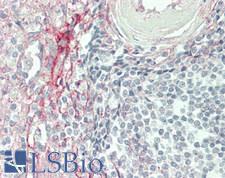 CD105 Antibody - Human Spleen: Formalin-Fixed, Paraffin-Embedded (FFPE)