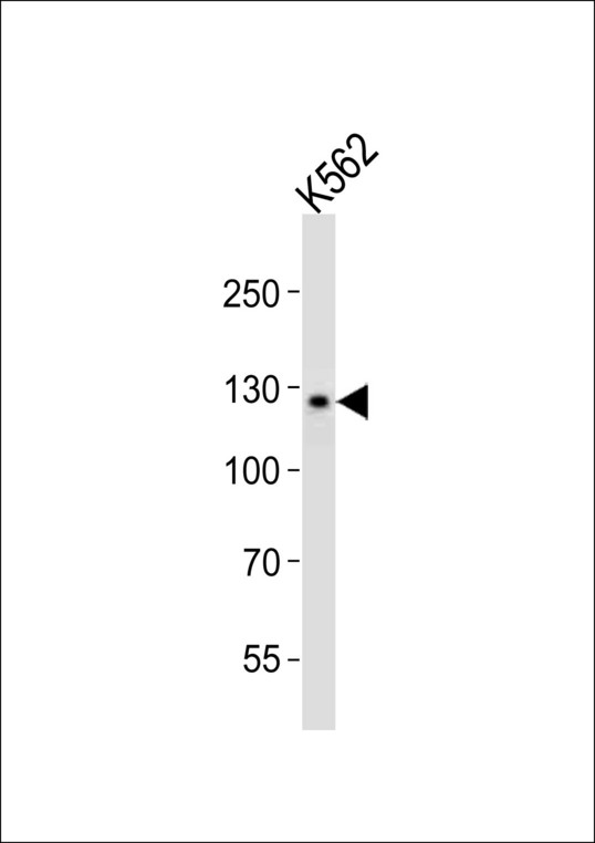 CD118 / LIF Receptor Alpha Antibody - Western blot of lysate from K562 cell line, using LIFR antibody diluted at 1:1000. A goat anti-rabbit IgG H&L (HRP) at 1:10000 dilution was used as the secondary antibody. Lysate at 20 ug.