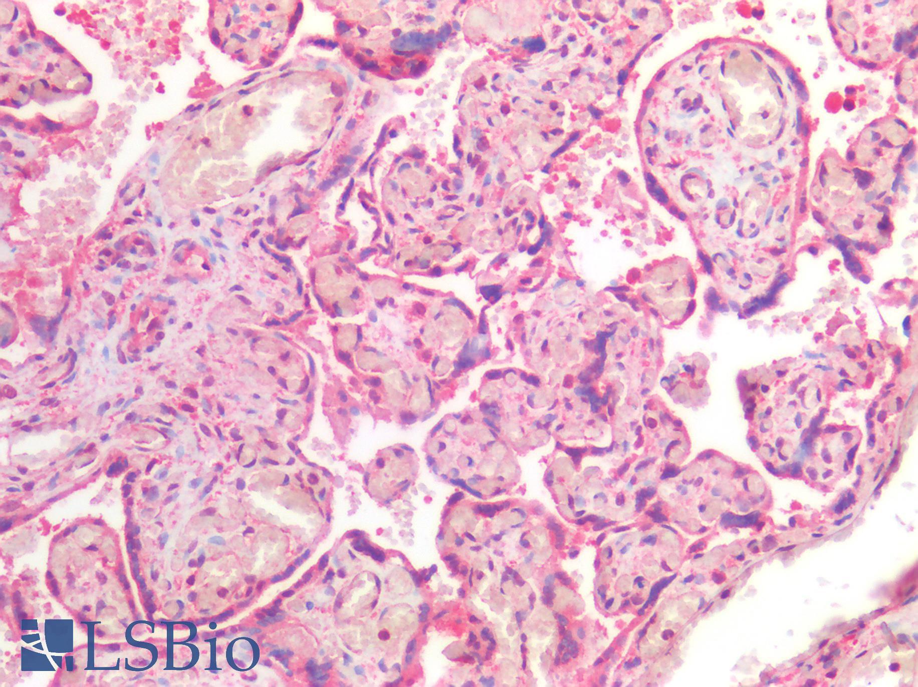CD118 / LIF Receptor Alpha Antibody - Human Placenta: Formalin-Fixed, Paraffin-Embedded (FFPE)