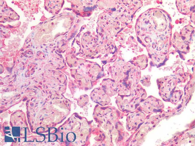 CD118 / LIF Receptor Alpha Antibody - Human Placenta: Formalin-Fixed, Paraffin-Embedded (FFPE)