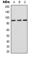 CD119 / IFNGR1 Antibody - Western blot analysis of IFNGR1 expression in Jurkat (A); HepG2 (B); COS7 (C) whole cell lysates.