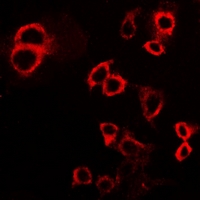 CD119 / IFNGR1 Antibody - Immunofluorescent analysis of IFNGR1 staining in HepG2 cells. Formalin-fixed cells were permeabilized with 0.1% Triton X-100 in TBS for 5-10 minutes and blocked with 3% BSA-PBS for 30 minutes at room temperature. Cells were probed with the primary antibody in 3% BSA-PBS and incubated overnight at 4 deg C in a humidified chamber. Cells were washed with PBST and incubated with a DyLight 594-conjugated secondary antibody (red) in PBS at room temperature in the dark. DAPI was used to stain the cell nuclei (blue).