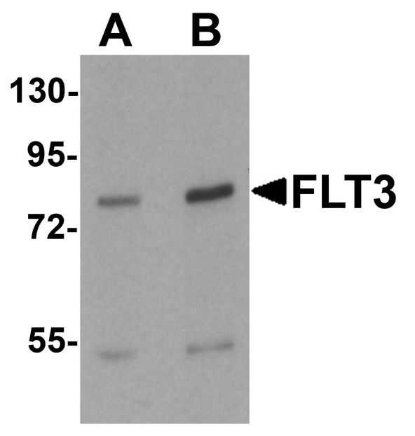 CD135 / FLT3 Antibody - Western blot analysis of FLT3 in 3T3 cell lysate with FLT3 antibody at (A) 1 and (B)2 ug/ml.