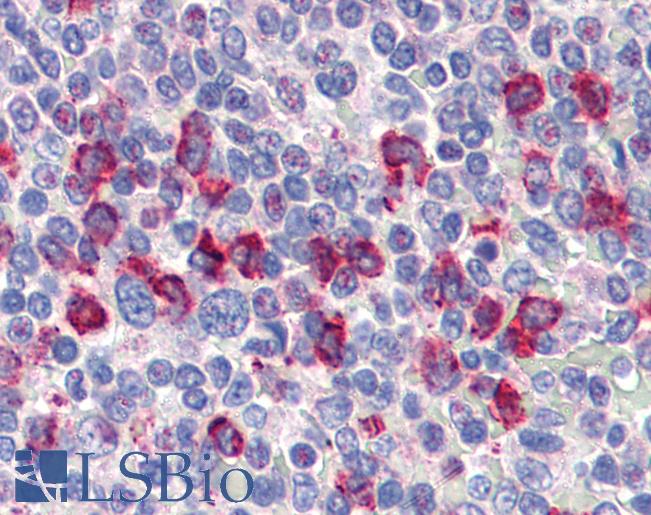 CD14 Antibody - Anti-CD14 antibody IHC of human spleen. Immunohistochemistry of formalin-fixed, paraffin-embedded tissue after heat-induced antigen retrieval. Antibody concentration 4 ug/ml.