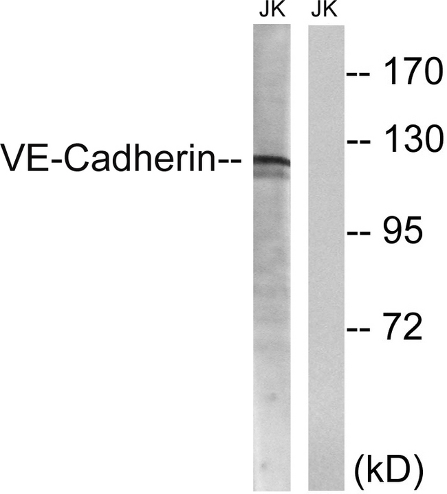 CD144 / CDH5 / VE Cadherin Antibody - Western blot analysis of lysates from Jurkat cells, using VE-Cadherin Antibody. The lane on the right is blocked with the synthesized peptide.