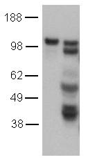 CD144 / CDH5 / VE Cadherin Antibody - EDTA-passaged (left) and Trypsin-passaged (right) Human Umbilical Vein Endothelial Cells (HUVEC) were lysed, and lysates were loaded at 1x105 cells/lane, probed with 2 ug/mL purified 16B1 and revealed with HRP anti-rat IgG.