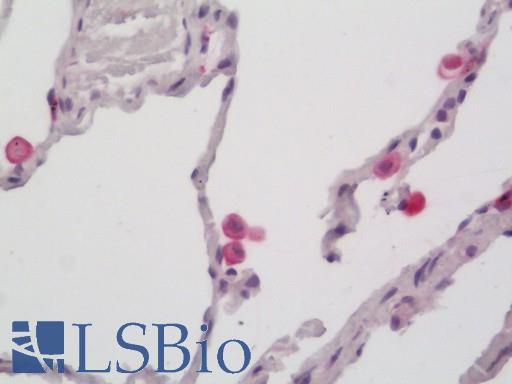 CD163 Antibody - Human Lung: Formalin-Fixed, Paraffin-Embedded (FFPE)