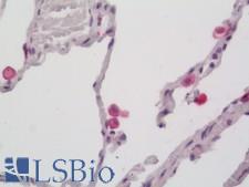 CD163 Antibody - Human Lung: Formalin-Fixed, Paraffin-Embedded (FFPE)