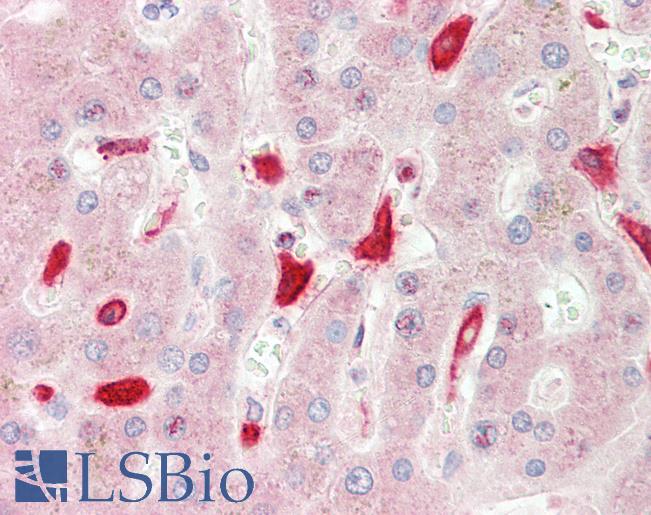 CD163 Antibody - Anti-CD163 antibody IHC staining of human liver. Immunohistochemistry of formalin-fixed, paraffin-embedded tissue after heat-induced antigen retrieval. Antibody concentration 10 ug/ml.