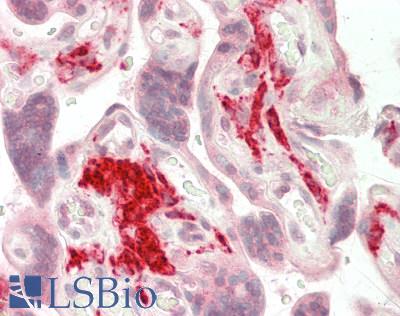 CD163 Antibody - Human Placenta: Formalin-Fixed, Paraffin-Embedded (FFPE)