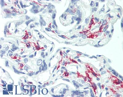 CD163 Antibody - Human Placenta: Formalin-Fixed, Paraffin-Embedded (FFPE)