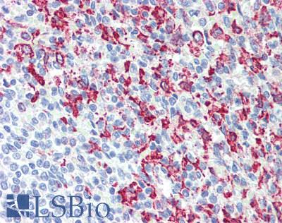 CD163 Antibody - Human Spleen: Formalin-Fixed, Paraffin-Embedded (FFPE)