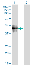 CD177 Antibody - Western blot of CD177 expression in transfected 293T cell line by CD177 monoclonal antibody, clone 4C4.
