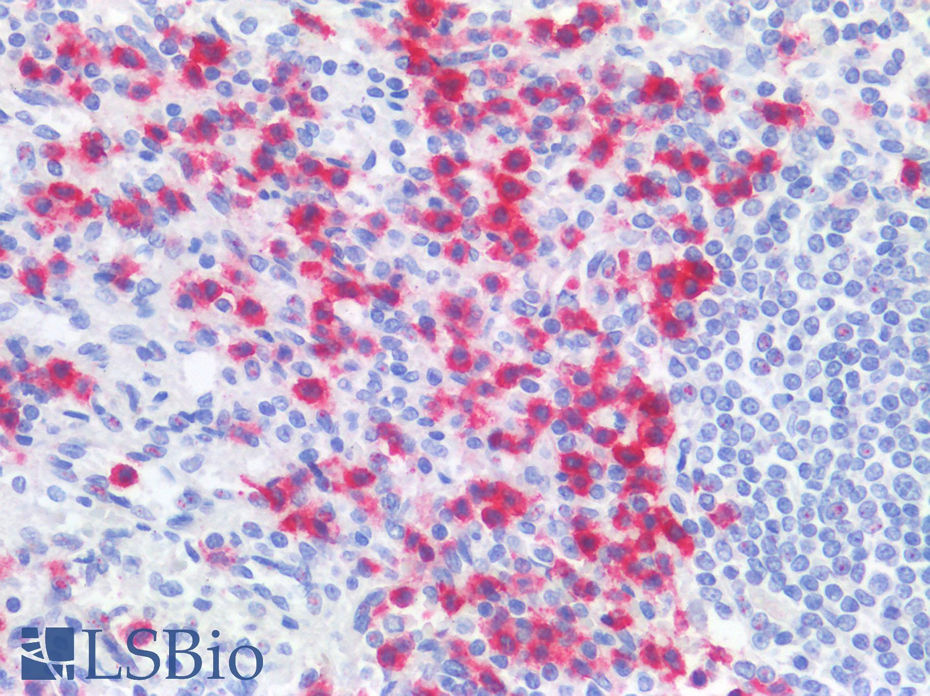 CD177 Antibody - Human Spleen: Formalin-Fixed, Paraffin-Embedded (FFPE)