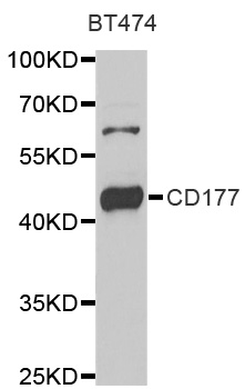 CD177 Antibody - Western blot analysis of extracts of BT474 cells.