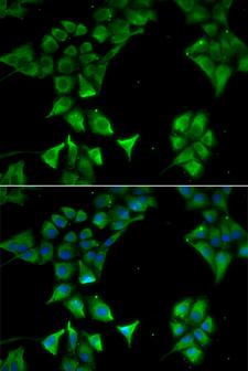 CD177 Antibody - Immunofluorescence analysis of HeLa cells.