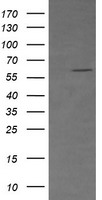 CD19 Antibody - HEK293T cells were transfected with the pCMV6-ENTRY control (Left lane) or pCMV6-ENTRY CD19 (Right lane) cDNA for 48 hrs and lysed. Equivalent amounts of cell lysates (5 ug per lane) were separated by SDS-PAGE and immunoblotted with anti-CD19.