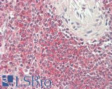 CD19 Antibody - Human Spleen: Formalin-Fixed, Paraffin-Embedded (FFPE)