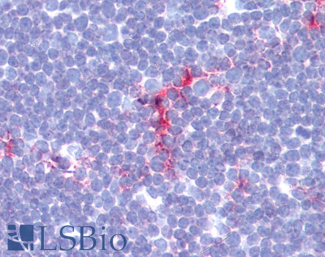 CD1A Antibody - Anti-CD1A antibody IHC of human thymus. Immunohistochemistry of formalin-fixed, paraffin-embedded tissue after heat-induced antigen retrieval. Antibody dilution 1:100.