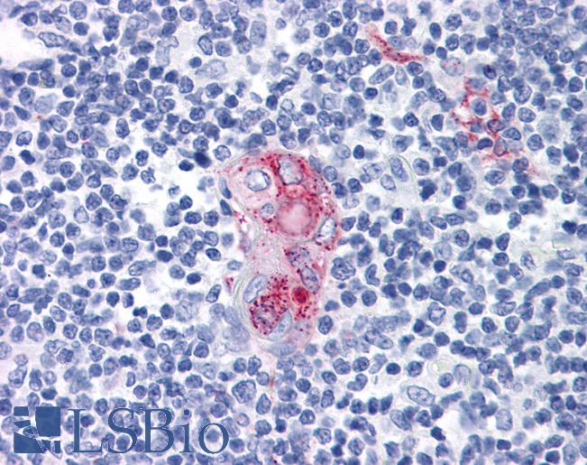 CD1D Antibody - Anti-CD1D antibody IHC of human thymus. Immunohistochemistry of formalin-fixed, paraffin-embedded tissue after heat-induced antigen retrieval. Antibody concentration 20 ug/ml.