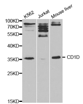 CD1D Antibody - Western blot analysis of extracts of various cell lines, using CD1D antibody at 1:1000 dilution. The secondary antibody used was an HRP Goat Anti-Rabbit IgG (H+L) at 1:10000 dilution. Lysates were loaded 25ug per lane and 3% nonfat dry milk in TBST was used for blocking.